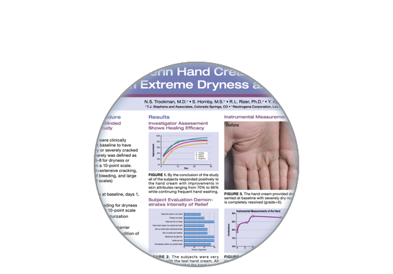 Étude sur la crème pour les mains à haute teneur en glycérine